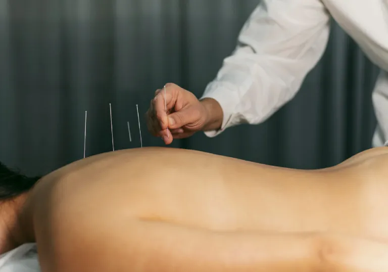 Hijama & Physiotherapy in Al Nahda Dubai