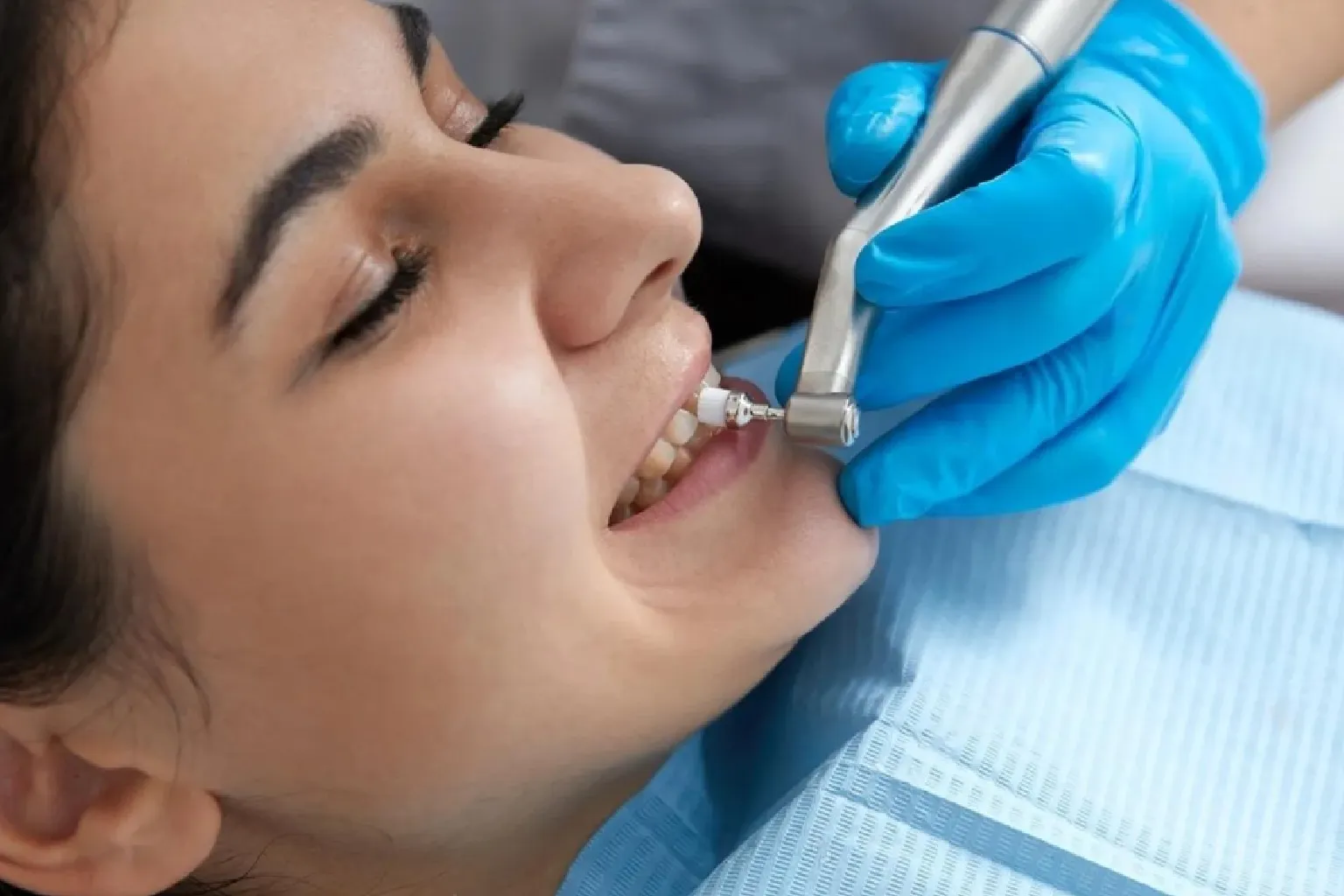 Oral Hygiene in Dubai